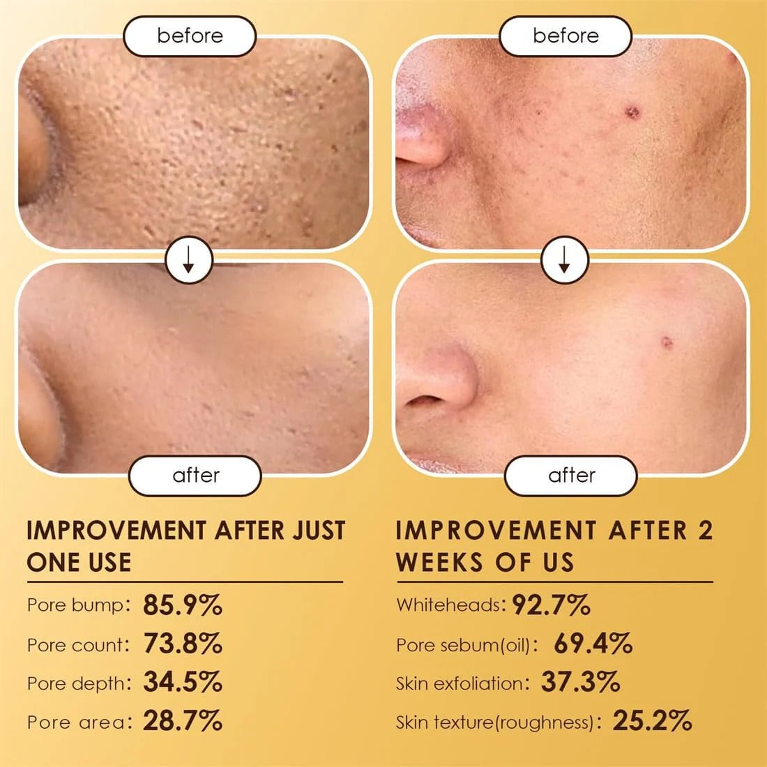 Dr Melaxin Peel Shot